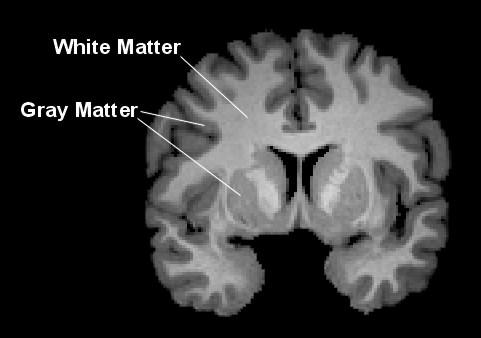 white, gray matter